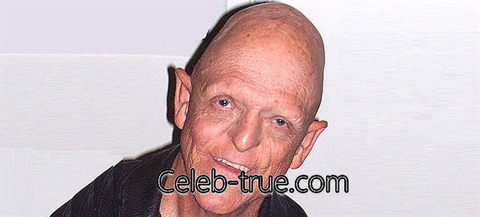 Michael Berryman je ameriški igralec, najbolj znan po svojih ikoničnih vlogah v filmih grozljivk
